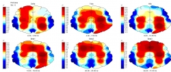 Sala de Polissonografia - Clínica NeuroSaúde - Diagnóstico em Neurologia